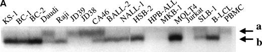 Fig. 3. Structural analysis of p73 in leukemia and lymphoma. (A) PCR-SSCP analysis of p73-cDNA from cell lines. Sequencing of RT-PCR products of representative samples showed that no mutations were present and the differences in migration of the bands were derived from the polymorphisms at codons 336 and 349. Arrow (a) indicates the band appearing when codons 336 and 349 nucleotides are GCC and CAT, and arrow (b) indicates the band appearing when codons 336 and 349 nucleotides are GCT and CAC, respectively. (B) Southern blot analysis of the p73 gene from p73 nonexpressing lymphoid cell lines. (B1) A 0.8-kb EcoRI fragment of pBS-M13-p73, which covers exons 2 through 6, was used as a probe. Lanes 1 and 7, peripheral blood mononuclear cells; lanes 2 and 8, Hela; lanes 3 and 9, TALL-1; lanes 4 and 10, RPMI8402; lanes 5 and 11, ALL-Sil; lanes 6 and 12, BALL-1. (B2) Probe CD, which covers exons 7-9, was used as a probe. Lane 1, Raji; lane 2, HL60; lane 3, HUT78; lane 4, U937; lane 5, Jurkat; lane 6, SKW3; lane 7, TALL-1; lane 8, CEM; lane 9, ALL-Sil; lane 10, RPMI8402; lane 11, KOPT-K1; lane 12, DS179; lane 13, NALM18; lane 14, BALL-1. Lanes 6, 7, 9, 10, 12, 13, and 14 are p73-negative cell lines as measured by RT-PCR.