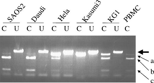 Fig. 4. Allelic expression of p73. Differential expression was detected by NlaIII digestion of RT-PCR products. The large arrow indicates the uncut band (390 bp). The small arrow (a) indicates the 358-bp product (NlaIII cuts at codon 223) when codon 349 is CAC (not cut with NlaIII). The small arrows (b) and (c) indicate the 277-bp and 89-bp bands, respectively, afterNlaIII cuts at both codon 349 (CAT) and codon 223. C, cut withNlaIII; U, uncut.