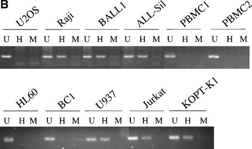 Fig. 5. (A) Nucleotide sequence of the CpG island in exon 1. Putative methylation sites of exon 1 are illustrated. CG sequences are bold, and the HpaII/MspI sites are underlined. Numbers above the nucleotide sequence are based on the cDNA sequence in the European Molecular Biology Laboratory database under the accession number Y11416EMBL. (B) Methylation status of CpG island in exon 1. Digests of 20 ng of genomic DNA with either HpaII orMspI were amplified by PCR using primers that amplify the entire exon 1 DNA (77 bp). U, uncut; H, HpaII; M,MspI.