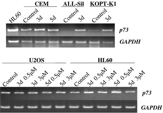Fig. 6. Induction of p73 expression after culture with 5-AC (RT-PCR). U2OS and HL60 were cultured with 5-AC for 3 and 5 days at 1 and 5 μmol/L, and 0.5 and 3 μmol/L, respectively. CEM, ALL-Sil, and KOPT-K1 were treated with 5-AC for 3 days at 3 μmol/L.