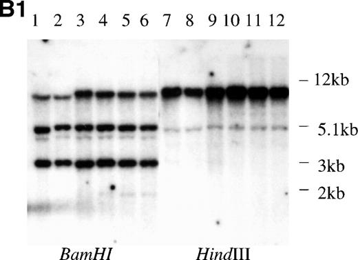 Fig. 3. Structural analysis of p73 in leukemia and lymphoma. (A) PCR-SSCP analysis of p73-cDNA from cell lines. Sequencing of RT-PCR products of representative samples showed that no mutations were present and the differences in migration of the bands were derived from the polymorphisms at codons 336 and 349. Arrow (a) indicates the band appearing when codons 336 and 349 nucleotides are GCC and CAT, and arrow (b) indicates the band appearing when codons 336 and 349 nucleotides are GCT and CAC, respectively. (B) Southern blot analysis of the p73 gene from p73 nonexpressing lymphoid cell lines. (B1) A 0.8-kb EcoRI fragment of pBS-M13-p73, which covers exons 2 through 6, was used as a probe. Lanes 1 and 7, peripheral blood mononuclear cells; lanes 2 and 8, Hela; lanes 3 and 9, TALL-1; lanes 4 and 10, RPMI8402; lanes 5 and 11, ALL-Sil; lanes 6 and 12, BALL-1. (B2) Probe CD, which covers exons 7-9, was used as a probe. Lane 1, Raji; lane 2, HL60; lane 3, HUT78; lane 4, U937; lane 5, Jurkat; lane 6, SKW3; lane 7, TALL-1; lane 8, CEM; lane 9, ALL-Sil; lane 10, RPMI8402; lane 11, KOPT-K1; lane 12, DS179; lane 13, NALM18; lane 14, BALL-1. Lanes 6, 7, 9, 10, 12, 13, and 14 are p73-negative cell lines as measured by RT-PCR.