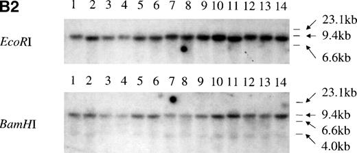 Fig. 3. Structural analysis of p73 in leukemia and lymphoma. (A) PCR-SSCP analysis of p73-cDNA from cell lines. Sequencing of RT-PCR products of representative samples showed that no mutations were present and the differences in migration of the bands were derived from the polymorphisms at codons 336 and 349. Arrow (a) indicates the band appearing when codons 336 and 349 nucleotides are GCC and CAT, and arrow (b) indicates the band appearing when codons 336 and 349 nucleotides are GCT and CAC, respectively. (B) Southern blot analysis of the p73 gene from p73 nonexpressing lymphoid cell lines. (B1) A 0.8-kb EcoRI fragment of pBS-M13-p73, which covers exons 2 through 6, was used as a probe. Lanes 1 and 7, peripheral blood mononuclear cells; lanes 2 and 8, Hela; lanes 3 and 9, TALL-1; lanes 4 and 10, RPMI8402; lanes 5 and 11, ALL-Sil; lanes 6 and 12, BALL-1. (B2) Probe CD, which covers exons 7-9, was used as a probe. Lane 1, Raji; lane 2, HL60; lane 3, HUT78; lane 4, U937; lane 5, Jurkat; lane 6, SKW3; lane 7, TALL-1; lane 8, CEM; lane 9, ALL-Sil; lane 10, RPMI8402; lane 11, KOPT-K1; lane 12, DS179; lane 13, NALM18; lane 14, BALL-1. Lanes 6, 7, 9, 10, 12, 13, and 14 are p73-negative cell lines as measured by RT-PCR.
