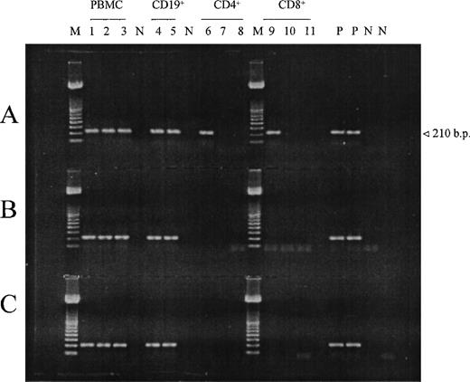 Fig. 1. Ethidium bromide–stained agarose gel of HCV-amplified products after nested-PCR of PBMC and PBMC subsets of 3 patients (A, B, C, respectively) before and after mitogenic stimulation of cells. Lanes 1 through 3, PBMC at day 0, 7, 14 of stimulation; lanes 4 and 5, B lymphocytes at day 0, 7; lanes 6 through 8 and lanes 9 through 11, CD4+ and CD8+ cells at day 0, 7, 14 of stimulation, respectively. Day 0 corresponds to unstimulated cells. N, negative controls (serum samples from healthy blood donors); P, positive controls (serum samples with a known amount of HCV-RNA); M, DNA size markers.