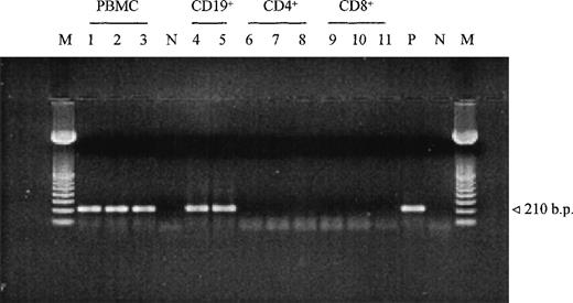 Fig. 2. Detection of HCV-RNA minus strand after ethidium bromide–stained agarose gel of HCV-amplified products of 1 patient with chronic hepatitis, before and after stimulation of cells. Lanes 1 through 3, total PBMC at day 0, 7, 14; lanes 4 and 5, B lymphocytes at day 0, 7; lanes 6 through 8 and lanes 9 through 11, CD4+ and CD8+ cells at day 0, 7, 14 of stimulation, respectively. Day 0 corresponds to unstimulated cells. M, DNA size markers; N, negative control; P, positive control.