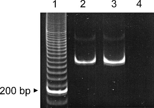 Fig. 2. Detection of β2 laminin mRNA by RT-PCR. mRNA was obtained from MACS-purified normal CD34+ peripheral blood progenitor cells and an oral squamous cell carcinoma cell line (positive control). RT-PCR (40 cycles) of the laminin β2 chain subunit mRNA resulted in a 315-bp fragment. Lane 1, 20-bp ladder; lane 2, CD34+ cells; lane 3, oral squamous cell carcionoma cell line; lane 4, control (primers only).