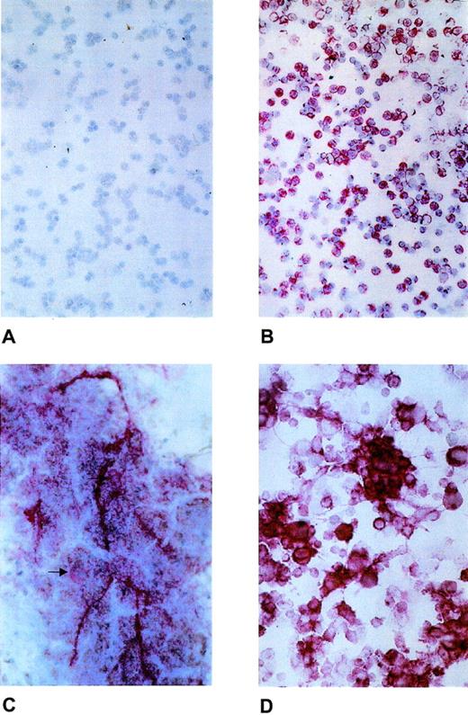 Fig. 1. Expression of laminin β2 chain in normal human bone marrow and ex vivo–expanded CD34+ peripheral blood progenitor cells. (A) Negative control with nonimmune mouse serum. (B) Laminin β2 chain expression as pericellular staining of bone marrow mononuclear cells. (C) Laminin β2 chain expression of normal megakaryocytes (arrow) and as extracellular deposition. (D) Laminin β2 chain expression in hematopoietic cells generated ex vivo from purified CD34+ peripheral blood progenitor cells.