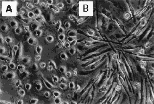 Fig. 1. Photographs of normal human blood monocytes, GM-CSF– and M-CSF–induced macrophages. Monocytes were cultured in RPMI 1640 medium plus 7.5% FCS in the presence of (A) rhGM-CSF (500 U/mL) or (B) rhM-CSF (100 ng/mL) for 7 days.
