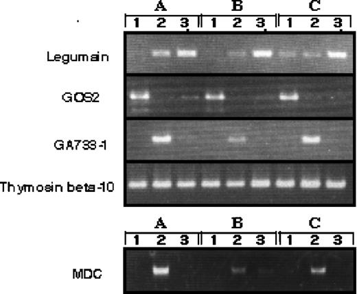Fig. 3. RT-PCR analysis of genes expressed differently in monocytes, M-CSF–, and GM-CSF–induced macrophages. RT-PCR was performed on total RNA isolated from 1, human monocytes; 2, GM-CSF–induced macrophages; 3, M-CSF–induced macrophages. A, B, and C indicate different donors.