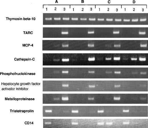 Fig. 3. RT-PCR analysis of genes expressed differently in Mo, GM-CSF–induced M◊, and DCs. RT-PCR was performed on total RNA isolated from (1) human Mo, (2) GM-CSF–induced M◊, and (3) Mo-derived DCs as described in Materials and Methods. (A) through (D) indicate different donors.