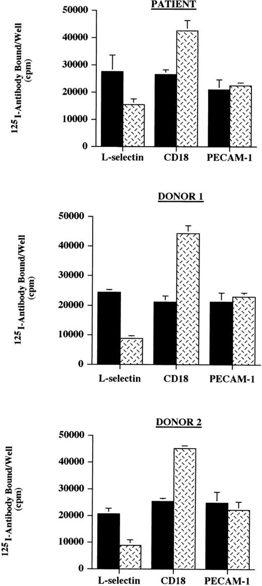 Fig. 1. Neutrophil binding of 125I-labeled antibodies. Neutrophils (1 × 106) from the patient and 2 normal donors, unactivated (control, ▪) or activated with the combination of TNF- and fMLP (TNF/fMLP, ), were incubated with125I-labeled antibodies against L-selectin, CD18, and PECAM-1 in a 96-well plate. The expression of these cell adhesion molecules was assessed by the binding of labeled antibody as determined by the total counts per well of cells. The expression of L-selectin, CD18, and PECAM-1 on the patient’s neutrophils were comparable with the expression found on neutrophils from normal control donors and stimulation with TNF- and fMLP decreased the expression of L-selectin and increased the surface level of CD18 as has been previously reported. These data are representative of 3 experiments done in triplicate in which the patient was compared with 2 normal donors and in which different normal donors were used in each experiment.
