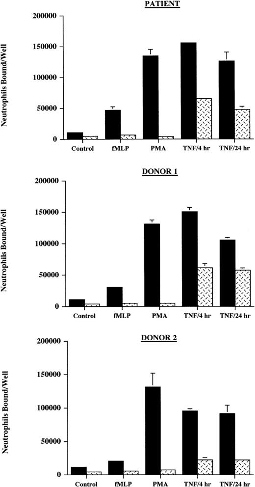 Fig. 4. Neutrophil adhesion to endothelial cells. The adhesion of111Indium-labeled neutrophils from the patient and 2 normal donors, without (▪) or with () anti-CD18 antibody, to monolayers of normal endothelial cells (HUVEC) was studied in 2 ways. Neutrophils were activated with fMLP (10−6 mol/L) or PMA (2 μg/mL) and added to unstimulated endothelium or unstimulated neutrophils were added to endothelium stimulated with TNF- (2 ng/mL) for 4 hours or 24 hours. Neutrophils bound to the endothelium per well was determined. Control indicates the adhesion of unactivated neutrophils to unstimulated endothelial cells. In these multiple conditions, adhesion of the patient’s neutrophils to endothelium did not differ significantly from that of the normal donors. These data are representative of 3 experiments done in duplicate or triplicate in which the patient was compared with 2 normal donors and in which different normal donors were used in each experiment.