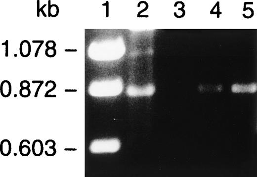Fig. 11. RT-PCR of surgical tissue from the patient. RT-PCR using primers designed to amplify the lectin and epidermal growth-like domains was conducted on total cellular RNA isolated from surgical tissue from the patient that included normal tissue from the margins of the surgical amputation (lane 3) and ulcerated nonhealing inflamed tissue from two distinct sites (lanes 4 and 5). PCR with these primers of E-selectin cDNA (lane 2) yielded the expected product of 870 bp. An identical product was also identified in tissue samples from the abnormal, inflamed tissue (lanes 4 and 5) but was not readily detected in normal tissue at the surgical margin (lane 3).