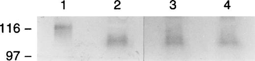 Fig. 12. Western blot analysis of sera for E-selectin. TNF-–stimulated HUVEC extracts (lane 1) and sera from the patient (lane 2) and from 2 normal donor controls (lanes 3 and 4) were transferred to nitrocellulose and immunoblotted with an anti–E-selectin antibody. A single molecular species was detected in the patient’s serum of approximately 100 to 110 kD, comparable in size with the form noted in control sera and appropriately smaller than the full-length species found in extracts from endothelial cells stimulated with TNF-.