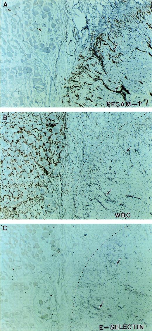 Fig. 8. Expression of E-selectin in inflamed tissue. Immunohistochemical staining of serial sections at the junction between viable and necrotic tissue indicated by the dotted line. Sections were stained with antibodies against PECAM-1 (A), Mac-1 (B), and E-selectin (C). There is intense neovascularization at the interface of viable and necrotic tissue (A) and infiltration of Mac-1–positive leukocytes (neutrophils and monocytes) in the necrotic tissue (B). Despite this indication of active inflammation, no significant expression of E-selectin was detected on any of the vessels in this tissue (arrows).