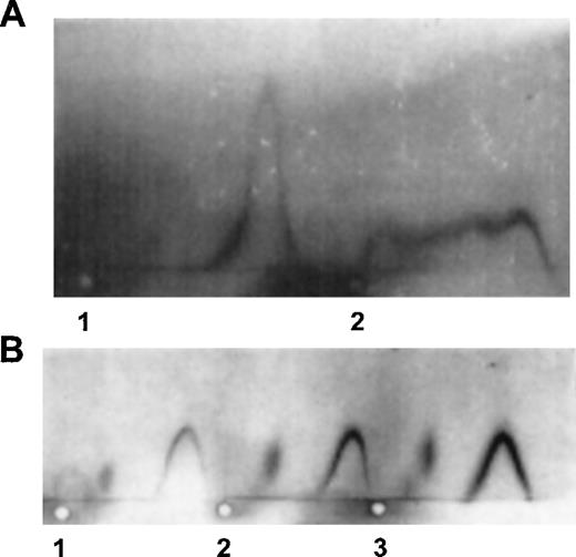 Fig. 2. Crossed immunoelectrophoresis of purified APC (A) or protein C in plasma (B) in the presence of control or patient’s IgG. Polyclonal rabbit antihuman protein C antiserum was used for detection of either APC or protein C as described in Materials and Methods. (A) Electrophoresis of 20 μL TBS-BSA containing 150 ng APC and 200 μg of control IgG (1) or patient’s IgG (2). (B) Electrophoresis of 10 μL of patient’s plasma (1), a mixture of 10 μL of normal plasma (40 ng protein C), and 10 μL of normal IgG (140 μg) (2) or 10 μL of normal plasma and 10 μL (140 μg) patient’s IgG (3).