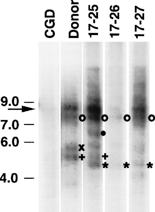Fig. 4. Southern blot analysis of proviral integration in secondary transplant recipients after MSCV-m91Neo transduction of X-CGD bone marrow. Genomic DNA was extracted from bone marrow obtained from an X-CGD control mouse, an X-CGD mouse used as a donor for secondary transplants 11 months posttransplantation with MSCV-m91–transduced BM, and three secondary transplant recipients (17-25, 17-26, and 17-27). Ten micrograms of genomic DNA was digested with EcoRI to generate junctional fragments containing provirus and adjacent genomic DNA. After agarose gel electrophoresis, Southern blots were prepared and probed with radiolabeled neomycin phosphotransferase cDNA. The band derived from an endogenous Neo gene in the X-CGD mice is marked by an arrow on the left. Open circles indicate a junctional fragment present in the donor that was also seen in all three recipient mice. Other junctional fragments were seen only in some or all of recipient mice (indicated by the other symbols).