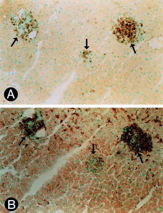 Fig. 2. Immunohistochemistry of cellular infiltrates. (A) Immunostaining of liver infiltrates with anti-CD3 antibody. Closed arrows identify positive staining cells in each infiltrate (OM × 720). (B) Immunostaining of liver infiltrates with anti-F4/80 antibody. Closed arrows identify positive staining cells in each infiltrate (OM × 720). Sections shown in (A) and (B) are serial sections.