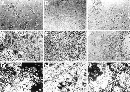 Fig. 2. Influence of HA and of HA’ase on formation of the adherent layer. Primary bone marrow cells were cultured in 6-well plates without any addition (A, D, and G) or with the addition of 100 μg/mL of HA (B, E, and H) or with 0.1 U/mL HA’ase (C, F, and I). Photographs were taken after 1 (top panel), 4 (middle panel), and 8 (bottom panel) weeks of culture. Only adherent cells are shown. In (D), (E), (G), and (H), typical cobblestone-like cells are visible, which are increased in number in (E) and (H), whereas in (F) and (I) such cells are hardly detectable. The magnification was 400-fold.