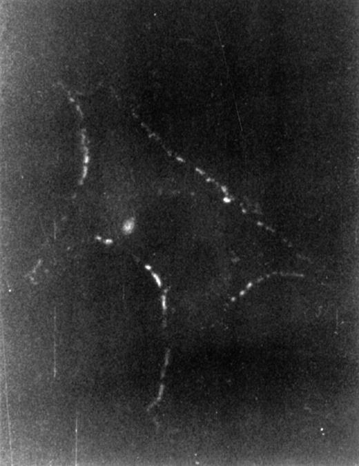 Fig. 5. Binding of HA to macrophage cells. After 4 weeks, LTBMC nonadherent cells were washed out, adherent cells were treated for 30 minutes at 37°C with HA’ase (5 U/mL), and then fixed with 3% paraformaldehyde and incubated with FITC-labeled HA at 4°C for 30 minutes. Immunofluorescence-staining of a representative cell is shown. Magnification was 1,000-fold. Similar staining was observed without HA’ase treatment.