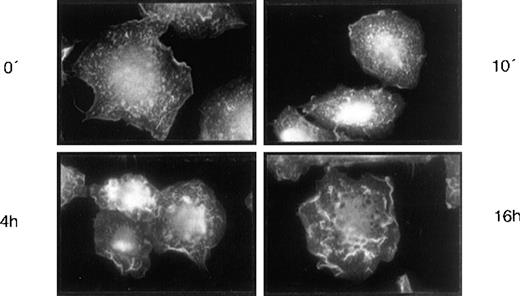 Fig. 7. HA-induced actin rearrangement in LTBMC adherent cells. Adherent cells of LTBMCs after 4 weeks in culture were incubated with HA (100 mg/μL) for 10 minutes, 4 hours, and 16 hours, respectively. Staining of the actin cytoskeleton by phalloidine-rhodamine (Materials and Methods) is shown. Magnification was 1,000-fold.