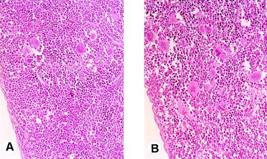 Fig. 1. Photographs of spleens of a littermate (A) and a Tg mouse (B) injected with hG-CSF. Note increased numbers of megakaryocytes in the spleen of the Tg mouse (original magnification ×100).