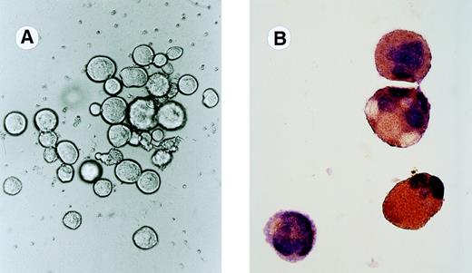 Fig. 2. (A) In situ appearance of a representative Mk colony induced by 20 ng/mL of hG-CSF from BM cells of hG-CSFR-Tg mice (original magnification ×200). (B) AChE-positive megakaryocytes in the Mk colony (original magnification ×400).