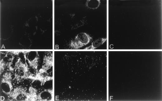 Fig. 2. Effect of homocysteine on the cellular localization of GRP78 and vWF. HUVEC plated on gelatin-coated glass coverslips were cultured in the absence (A,D) or presence (B,E) of 5.0 mmol/L homocysteine for 18 hours. After treatment, cells were fixed, permeabilized, and incubated with antibodies against either GRP78 (A,B) or vWF (D,E). Antibodies were subsequently detected using fluorescein-labeled secondary antibodies. Parallel experiments using normal mouse (C) or rabbit IgG (D) were performed to assess nonspecific immunofluorescence.