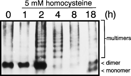 Fig. 3. Effect of homocysteine on vWF multimerization. HUVEC cultured in the absence or presence of 5.0 mmol/L homocysteine for 1, 2, 4, 8, or 18 hours were denatured in lysis buffer, the lysates fractionated on 1.2% (wt/vol) agarose gels and transferred to nitrocellulose. vWF monomers, dimers, and multimers were detected by immunoblotting using anti-vWF antibodies.