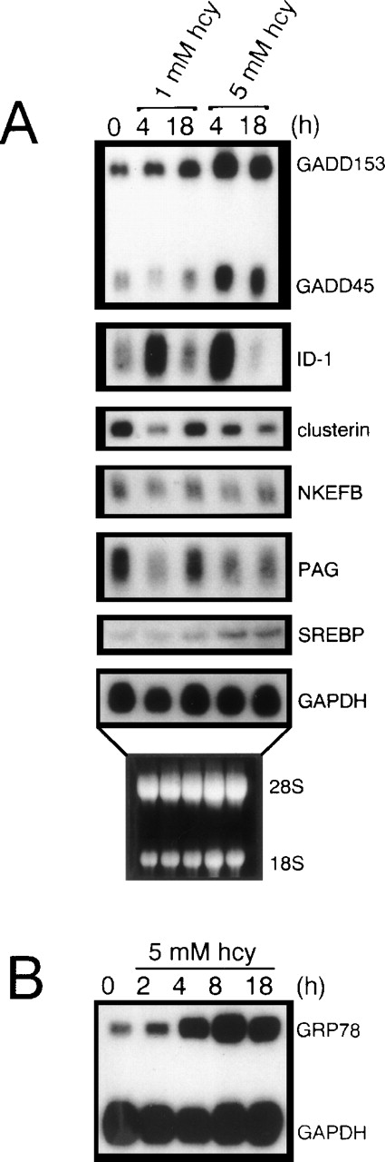 Fig. 6. Northern blot analysis substantiating the consistency of the cDNA microarray results. Total RNA (10 μg/lane) isolated from HUVEC cultured in the absence or presence of homocysteine for the indicated time periods was analyzed by Northern blot hybridization, followed by autoradiography. (A) Effect of homocysteine on Id-1, NKEFB, clusterin, PAG, SREBP, GADD153, and GADD45 mRNA levels. (B) Effect of homocysteine on GRP78 mRNA levels. Hybridization to a human GAPDH probe was used to normalize RNA loading. The results are representative of 2 separate experiments using 2 different samples of RNA.
