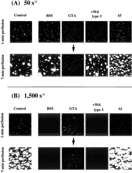 Fig. 2. Thrombus generation on a collagen-coated surface by blood from patients with various congenital platelet aggregation disorders perfused under (A) low or (B) high shear rate. BSS, Bernard-Soulier syndrome; GTA, Glanzmann’s thrombasthenia; vWD, von Willebrand disease; Af, congenital afibrinogenemia. Images were taken at 1 minute and 7 minutes after the beginning of perfusion of blood from one patient with each disease (numbered as “−1”; see Table 1); control images are identical to those in Fig 1. (A) Note the nearly unchanged image of thrombus formation in GTA blood at 7 minutes of perfusion; all other images at both 1 minute and 7 minutes of perfusion are comparable with the control. (B) Images correspond to blood of patients in (A). Note the absence of platelet-surface interaction in BSS and type 3 vWD even at 7 minutes of perfusion. Note also that the extent of platelet-surface interaction in GTA blood is comparable with that of the normal control at 1 minute of perfusion, while thrombus growth is absent in the GTA patient even at 7 minutes of perfusion.