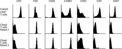 Fig. 1. Surface phenotype of clonal T cells from two hypereosinophilic patients. PBMC from two hypereosinophilic patients and from a healthy blood donor were stained with FITC-, PE-, or PerCP-conjugated MoAbs against CD4, CD3, CD2, CD28, CD45RO, CD25, CD7, and CD27 antigens. Flow cytometric determination of surface phenotype is shown after gating on CD4+ (healthy subject) or CD3−CD4+ (patients) lymphocytes. Data were obtained on more than 10,000 viable cells.