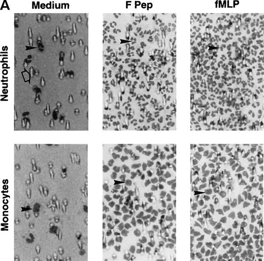 Fig. 3. Chemotactic activity of F peptide for monocytes and neutrophils. Different concentrations of F peptide were placed in the lower wells of the chemotaxis chamber. Monocytes or neutrophils were placed in the upper wells. After incubation at 37°C, the cells that migrated across the polycarbonate filter were counted and photographed. (A) Visualization (original magnification × 400) of neutrophil (upper panels) and monocyte (lower panels) migration in response to control medium (Medium), F peptide (F pep; 5 × 10−5 mol/L), and fMLF (fMLP; fMLP 10−7 mol/L). Solid arrows in the figure denote cells migrated across the filters. An open arrow in the upper-left panel indicates one of the micropores in the filter. (B) Fold increase (chemotaxis index) of phagocyte migration in response to F peptide over control medium. *P < .01 compared with spontaneous migration. (C) Inhibition of monocyte migration in response to F peptide by pertussis toxin. Cells preincubated with 100 ng/mL pertussis toxin (PT) at 37°C for 30 minutes were washed and examined for migration induced by different concentrations of F peptide. Cholera toxin (CT) at 100 ng/mL had no effect on monocyte migration induced by F peptide. *P < .01 compared with migration of cells incubated with medium alone.