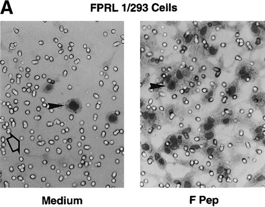 Fig. 5. Chemotactic activity of F peptide for FPRL1/293 cells. Different concentrations of F peptide were placed in the lower wells of the chemotaxis chamber. FPRL1/293 cells were placed in the upper wells. After incubation for 5 hours at 37°C, the cells that migrated across the polycarbonate filter were counted and photographed. (A) Visualization (original magnification × 200) of FPRL1/293 cell migration in response to control medium (Medium; left panel) or F peptide (F pep; 5 × 10−5 M; right panel). Solid arrows in the figure denote cells migrated across the filters. An open arrow in the left panel indicates one of the micropores in the filter. (B) Fold increase (chemotaxis index) of FRPL1/293 cell migration in response to F peptide over control medium. (C) Lack of chemotactic activity of F peptide for 293 cells transfected to express CCR5 or CXCR4. MIP-1β and SDF-1 at 10 ng/mL were used as positive controls. *P < .01 compared with spontaneous migration.