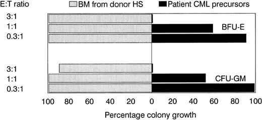 Fig. 3. Suppression of leukemic but not normal donor BFU-E and CFU-GM growth by leukemia-reactive CTL line 3. CTL line 3 was irradiated (10 Gy) and incubated for 4 hours with bone marrow MNC from donor HS or patient KG at various effector:target ratios. After 4 hours, the cells were resuspended in methylcellulose as a single-cell suspension and cultured in the presence of multiple hematopoietic growth factors. Progenitor cell growth is expressed as the percentage of BFU-E or CFU-GM growth in the absence of CTL. All metaphases from MNC of patient KG were t(9;22) positive.