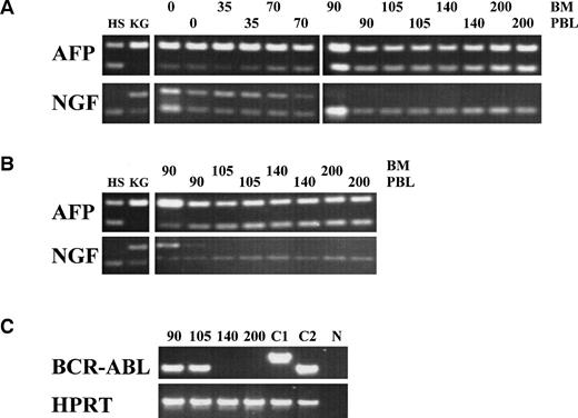 Fig. 5. Chimerism analysis and BCR/ABL minimal residual disease detection in bone marrow (BM) or peripheral blood (PBL) from the patient after treatment with leukemia-reactive CTL. Cells of donor (HS) origin could be detected by AFP polymorphism (heterozygous 145- and 72-bp fragments); cells of patient (KG) origin could be detected by NGF-β polymorphism (heterozygous for 100- and 50-bp fragments). (A) Between days 70 and 105 after the first CTL infusion, chimerism of MNC in BM and PBL completely converted to donor origin. (B) PMN from the patient were completely of donor origin from day 105 (5 weeks after the last CTL infusion). (C) Complete molecular remission was documented at day 140, 10 weeks after the last CTL infusion by disappearance of the patient b2a2 BCR/ABL transcript. C1, control b3a2 cDNA; C2, control b2a2 cDNA; N, negative control. RT-PCR of the HPRT gene served as an internal control for cDNA synthesis.