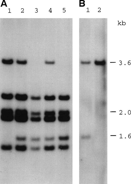 Fig. 2. Southern blot analysis showing the inheritance of a deletion at the 3′ end of the DKC1 gene. (A) Hybridization of a DKC1 probe 31g1K17 (cDNA nucleotides 744-1565) to Taq I digests of genomic DNA from the following family members: lane 1, mother of patient HO (I-1); lane 2, sister of patient HO (II-1); lane 3, patient HO (II-7); lane 4, niece of patient HO (III-1); and lane 5, nephew of patient HO (III-2). Numbers in brackets refer to the pedigree in Fig 5. Note that the 1.6-kb fragment produced by the deletion is not detected in the mother. (B) Hybridization of an MPP1 probe 39g1B21 (cDNA nucleotides 1117-1822) to Taq I digests of genomic DNA from the following: lane 1, patient HO; and lane 2, a normal control. Note that both probes hybridize to fragments of the same size. Two fragments of coincidental size are seen in the normal sample, 1 of which is deleted in patient HO.