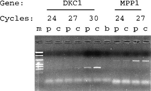 Fig. 3. RT-PCR amplification of the DKC1 and MPP1genes from patient HO (p) and a control sample (c). The number of PCR cycles is shown. The molecular weight marker (m) is the plasmid pEMBL8 cut with Taq I and Pvu II.