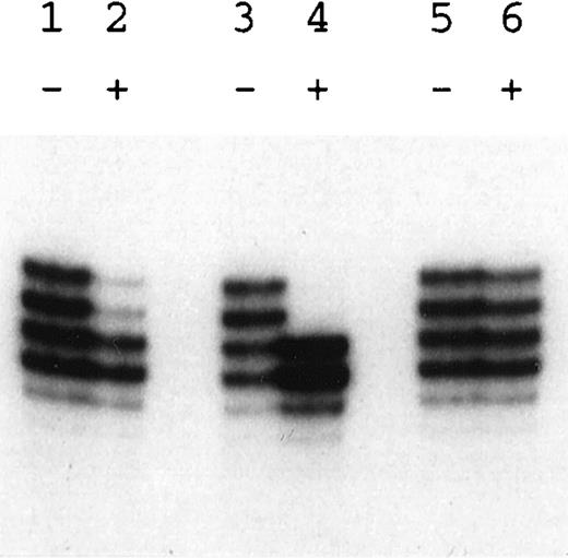 Fig. 6. Analysis of X-chromosome inactivation patterns. Amplification of the CAG repeat polymorphism at the HUMARA locus either without (−) or with (+) prior Hpa II digestion. Lanes 1 and 2, the mother of patient HO (I-1); lanes 3 through 6, the 2 sisters of patient HO (II-1 in lanes 3 and 4; II-4 in lanes 5 and 6). Note the completely skewed pattern in the carrier (lane 4), the random pattern in the normal sister (lane 6), and the incompletely skewed pattern in the mother (lane 2).