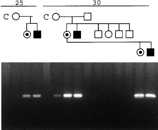 Fig. 7. Amplification of a deletion-specific product from genomic DNA of the mother of patient HO. The number of PCR cycles is shown at the top. Family members are drawn above the appropriate lanes. C, a control sample. Note the faint product seen in the mother after 30 cycles of PCR, using primers that flank the deletion.