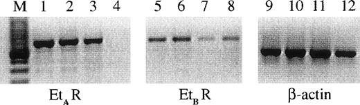 Fig. 1. The expression of ETA and ETBreceptors on CNS-EC and HUVECs. RNA from cells from 3 different CNS-EC cultures and 1 sample of HUVECs was extracted and examined using PCR primers for ETA (lanes 1 through 4), ETB (lanes 5 through 8) receptors, and β-actin (lanes 9 through 12). The CNS-EC are grouped in lanes 1, 5, and 9; 2, 6, and 10; and 3, 7, and 11. HUVEC RNA is shown in lanes 4, 8, and 12. M designates the marker lane.