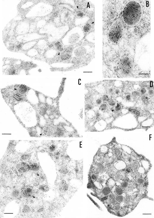 Fig. 3. Immunoelectronmicroscopy of platelet and megakaryocytes sections. Washed platelets and megakaryocytes were proceeded for transmission electron microscopy as described in Materials and Methods. Sections incubated with 75 μg/mL of 4PCI (A through E) showed positive staining in the OCS, in the  granules (arrowheads), and on the plasma membrane. Sections incubated with nonimmune-IgG (negative control, F) were devoid of gold staining. PCI labeling in the  granules (A through E, arrowheads) was distributed over all  granules and predominantly in the electron dense zone or nucleoid, although sometimes they were found to bind to the  granule membrane (A through E, arrowheads). The PCI staining pattern in megakaryocytes (G and H) was very similar to that seen in platelets. Gold particles often appeared in granules identifiable as  granules, as well as on the plasma membrane, and in the open canalicular system. Experiments of colocalization of PCI with PAI-1 (I through M) were performed as described in Materials and Methods. The gold particles of 10 and 5 nm indicate the presence of PCI and PAI-1, respectively. Colocalization demonstrates that the granules observed were indeed  granules. (A and C through G) Bars = 200 nm; (B and H through M) bars = 100 nm.