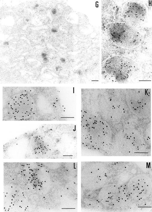 Fig. 3. Immunoelectronmicroscopy of platelet and megakaryocytes sections. Washed platelets and megakaryocytes were proceeded for transmission electron microscopy as described in Materials and Methods. Sections incubated with 75 μg/mL of 4PCI (A through E) showed positive staining in the OCS, in the  granules (arrowheads), and on the plasma membrane. Sections incubated with nonimmune-IgG (negative control, F) were devoid of gold staining. PCI labeling in the  granules (A through E, arrowheads) was distributed over all  granules and predominantly in the electron dense zone or nucleoid, although sometimes they were found to bind to the  granule membrane (A through E, arrowheads). The PCI staining pattern in megakaryocytes (G and H) was very similar to that seen in platelets. Gold particles often appeared in granules identifiable as  granules, as well as on the plasma membrane, and in the open canalicular system. Experiments of colocalization of PCI with PAI-1 (I through M) were performed as described in Materials and Methods. The gold particles of 10 and 5 nm indicate the presence of PCI and PAI-1, respectively. Colocalization demonstrates that the granules observed were indeed  granules. (A and C through G) Bars = 200 nm; (B and H through M) bars = 100 nm.