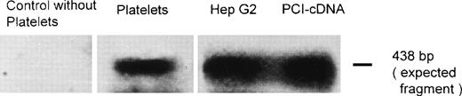 Fig. 5. RT-PCR and Southern blotting. Total RNA obtained from platelets and Hep G2 cells was subjected to RT-PCR and Southern blotting using primers specific for a 438-bp fragment of PCI-cDNA. A PCI-cDNA fragment inserted into the plasmid vector pBluescript II KS (+/−) phagemid was also amplified by PCR with the same primers. Additionally, a negative control was performed by amplifiying a sample without platelets. After blotting, the membrane was incubated with a32P-labeled PCI-cDNA fragment and subjected to autoradiography as described in Materials and Methods.