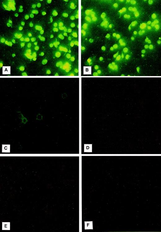 Fig. 2. Immunofluorescence microscopy: PCI in washed platelets. Smears of washed platelets isolated from whole blood were incubated with a monoclonal antibody against PCI (A), PAI-1 (B), factor D (C), or heparin cofactor II (D); in other negative control experiments with dilution buffer alone (E); or with a nonimmune mouse IgG (F), followed by fluorescein-conjugated goat-antimouse-IgG. PCI showed fluorescence intracellularly as well as PAI-1, which was used as a positive control (A and B, respectively), whereas a rim pattern of staining consistent with an exclusively surface localization of the protein, which was observed with the antibody to factor D (C), was not observed in case of PCI. Negative control experiments performed with an antibody to heparin cofactor II (D), with mouse-nonimmune IgG (F), or by incubation with dilution buffer alone (E) did not show any fluorescence. (Original magnification × 3,000; exposure time: 3 seconds.)
