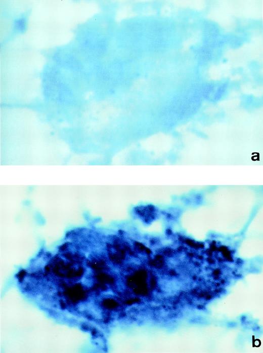 Fig. 6. In situ hybridization of human bone marrow cryosections. Sections of human bone marrow were incubated with DIG-labeled-cRNA sense (a) or antisense probe (b). Bound cRNA probes were detected with anti-digoxigenin-alkaline phosphatase Fab fragments, followed by incubation with NBT/BCIP color solution. The megakaryocytes observed in sections incubated with the PCI-cRNA antisense probe showed dark blue precipitates (b). Control sections incubated with the sense probe yielded negative results (a). (Original magnification × 1,000.)