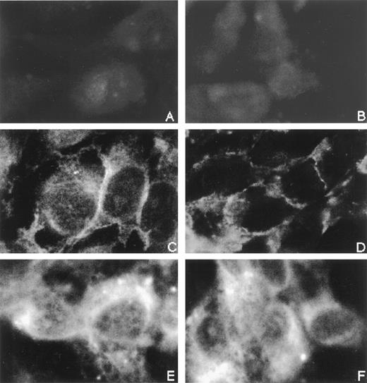 Fig. 1. Immunofluorescence staining of CD31 and vβ3 integrin on IL-4–stimulated vascular endothelial cells. HUVEC monolayers grown on the well of 24-well tissue culture plates were stimulated with IL-4 (100 ng/mL) for 8 hours at 37°C. IL-4–stimulated HUVECs were then incubated with anti-CD31 MoAb NIH31-1 (right panels; B, D, and F) or control mouse IgG (left panels; A, C, and E) (10 μg/mL each) for 10 minutes at 37°C, fixed in acetone, and stained with anti-CD31 MoAb-FITC (C and D), anti-vβ3 integrin MoAb-FITC (E and F), or control mouse IgG-FITC (A and B) (10 μg/mL each) for 60 minutes at room temperature. (Original magnification × 1,000.)