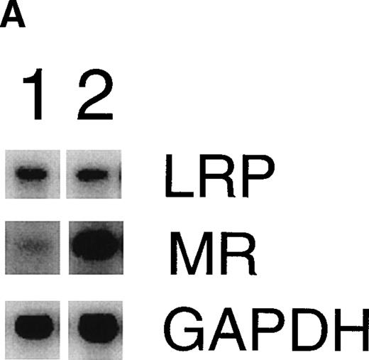 Fig. 4. Effect of EE treatment on hepatic LRP and mannose receptor mRNA expression in mice. (A) Total RNA was extracted from livers from vehicle- (lane 1) or EE-treated mice (lane 2) and analyzed by Northern blotting for LRP and mannose receptor (MR) mRNA levels. As a control for equal loading, the blots were probed with the cDNA for GAPDH mRNA. (B) The signals for LRP and MR mRNA were quantified by phosphoimager analysis and adjusted for the corresponding GAPDH mRNA signals. The results shown are the amounts of hepatic LRP and MR mRNA in EE-treated mice relative to those found in vehicle-treated mice. Data are expressed as the mean ± SD of 3 independent experiments consisting of at least 4 animals in each treatment group.