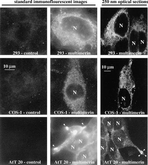 Fig. 1. The distribution of multimerin in transfected HEK 293, COS-1, and AtT 20 cells immunolabeled with polyclonal antimultimerin. Images acquired by standard immunofluorescent microscopy (left and middle panels) and confocal optical sectioning (right panels) are shown. Multimerin was not detected in control cells transfected with the empty vector (panels labeled control). In HEK 293 and COS-1 cells transiently transfected with the multimerin cDNA (panels labeled multimerin), recombinant multimerin was distributed throughout the cytoplasm, without evidence of granule formation. In AtT 20 cells transiently (standard immunofluorescent microscope image) and stably (confocal optical section image) transfected with the multimerin vector, multimerin was predominantly located in small granule-like structures that were most abundant at the distal cell tips (arrowheads; N indicate cell nuclei).