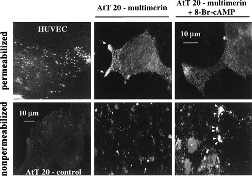 Fig. 2. Confocal microscopy images (250-nm optical sections) of human umbilical vein endothelial cells (HUVEC) and quiescent and secretagogue-treated (+) AtT 20 cells. Cells were immunolabeled with monoclonal antimultimerin after transfection with the empty vector (control) or the multimerin expression vector. The upper panels show images taken at a higher magnification. Multimerin was identified in small granule-like structures (permeabilized cells) that were concentrated at the cell tips of stably transfected AtT 20 cells (arrows). Twenty minutes after stimulation with 10 mmol/L 8-Br-cAMP, transfected AtT 20 cells showed intense multimerin labeling in release patches (arrowheads) around the cells that were not evident in control cells, and this redistribution was associated with reduced multimerin granule labeling at the cell tips (permeabilized cells).