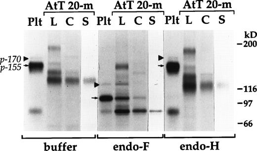 Fig. 7. Comparisons of N-linked carbohydrate on platelet (plt) and AtT 20 cell-derived multimerin. Cells were labeled for 28 hours as in Fig 6B; their multimerin radioimmunoprecipitates were treated with buffer, N-glycosidase F (endo-F), or endoglycosidase H (endo-H) and then separated using reduced 4% to 8% SDS-PAGE (lane L, multimerin constitutively secreted during the labeling; lane C, multimerin remaining in the cell lysate postchase; lane S, longer exposure showing the multimerin secreted postchase in response to 8-Br-cAMP). The125I-labeled platelet multimerin subunits p-155 (arrows) and p-170 (arrowheads) are indicated. The coprecipitated, 83-kD platelet protein, which was resistant to N-glycosidase F and N-glycosidase H, was not observed in all studies. The multimerin stored in AtT 20 cells was more extensively proteolyzed than constitutively secreted multimerin. Two of the multimerin subunits constitutively secreted by AtT 20 cells (lanes L) comigrated with p-155 and p-170 after their N-linked carbohydrates were removed with N-glycanase F. The major form of multimerin stored in AtT 20 cells (lanes C) was a proteolytic product smaller than platelet multimerin, although AtT 20 cells also stored a subunit that comigrated with p-155 after N-glycosidase F treatment. Endoglycosidase H-sensitive carbohydrate was detected on the mature multimerin stored and secreted from AtT 20 cells, but not on platelet multimerin.